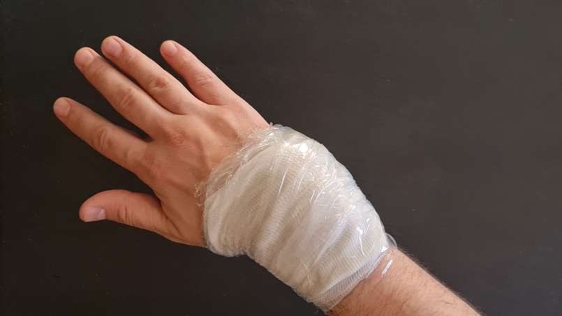 Cataplasma con loys e foglie di cavolo, foto 7