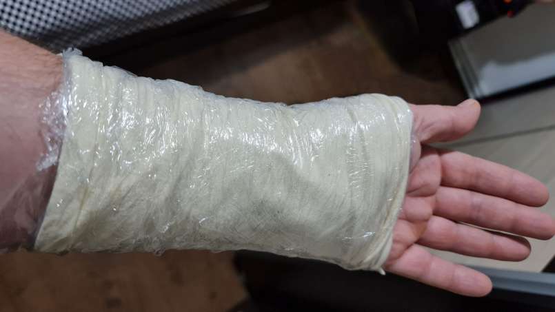 Cataplasma con loys e foglie di cavolo, foto 8